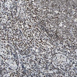 Invitrogen PNK Polyclonal Antibody 100 &mu;L; Unconjugated:Antibodies,