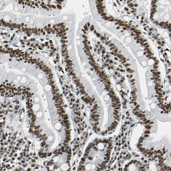 Invitrogen XRCC4 Polyclonal Antibody 100 &mu;L; Unconjugated:Antibodies,