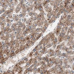 Invitrogen Hepsin Polyclonal Antibody 100 &mu;L; Unconjugated:Antibodies,