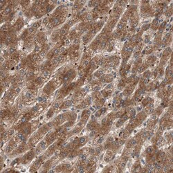 Invitrogen GLYCTK Polyclonal Antibody 100 &mu;L; Unconjugated:Antikroppar