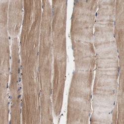 Invitrogen GLYCTK Polyclonal Antibody 100 &mu;L; Unconjugated:Antikroppar