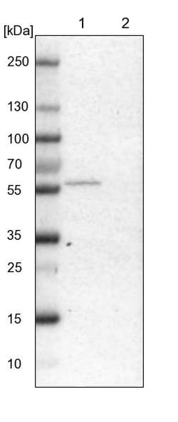 Invitrogen GLYCTK Polyclonal Antibody 100 &mu;L; Unconjugated:Antikroppar