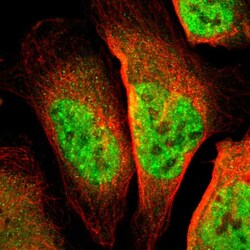Invitrogen TSHZ1 Polyclonal Antibody 100 &mu;L; Unconjugated:Antibodies,