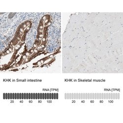 KHK Polyclonal Antibody, Invitrogen&trade;