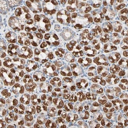 Invitrogen HK1 Polyclonal Antibody 100 &mu;L; Unconjugated:Antibodies,