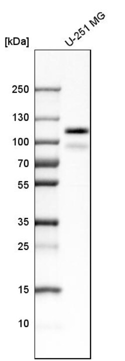 Invitrogen PTPN12 Polyclonal Antibody 100 &mu;L; Unconjugated:Antibodies,