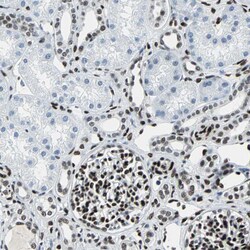 Invitrogen MEF2D Polyclonal Antibody 100 &mu;L | Buy Online | Invitrogen&trade; | Fisher Scientific