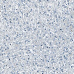 Invitrogen MEF2D Polyclonal Antibody 100 &mu;L | Buy Online | Invitrogen&trade; | Fisher Scientific