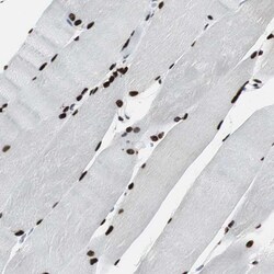 Invitrogen MEF2D Polyclonal Antibody 100 &mu;L | Buy Online | Invitrogen&trade; | Fisher Scientific