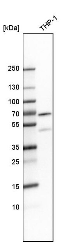 Invitrogen MEF2D Polyclonal Antibody 100 &mu;L | Buy Online | Invitrogen&trade; | Fisher Scientific
