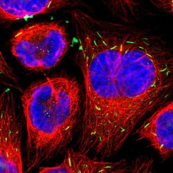 MST2 Polyclonal Antibody:Antibodies, Polyclonal
