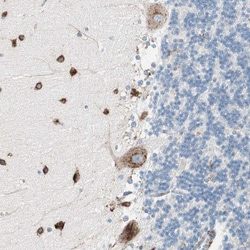 Invitrogen P4HTM Polyclonal Antibody 100 &mu;L; Unconjugated:Antibodies,