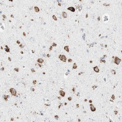 Invitrogen P4HTM Polyclonal Antibody 100 &mu;L; Unconjugated:Antibodies,