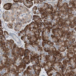 Invitrogen P4HTM Polyclonal Antibody 100 &mu;L; Unconjugated:Antibodies,