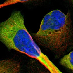 CD81 Polyclonal Antibody:Antibodies, Polyclonal
