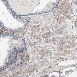 CD81 Polyclonal Antibody:Antibodies, Polyclonal