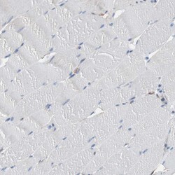 CD81 Polyclonal Antibody:Antibodies, Polyclonal