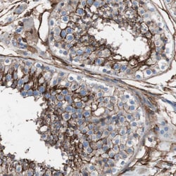 CD81 Polyclonal Antibody:Antibodies, Polyclonal