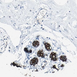Invitrogen Cytokeratin 7 Polyclonal Antibody 100 &mu;L; Unconjugated:Antibodies,