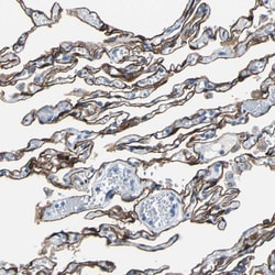 Invitrogen Cytokeratin 7 Polyclonal Antibody 100 &mu;L; Unconjugated:Antibodies,