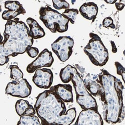 Invitrogen Cytokeratin 7 Polyclonal Antibody 100 &mu;L; Unconjugated:Antibodies,