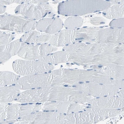 Invitrogen Cytokeratin 7 Polyclonal Antibody 100 &mu;L; Unconjugated:Antibodies,