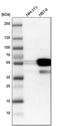 Invitrogen Cytokeratin 7 Polyclonal Antibody 100 &mu;L; Unconjugated:Antibodies,