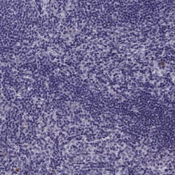 Invitrogen NQO1 Polyclonal Antibody 100 &mu;L | Buy Online | Invitrogen&trade; | Fisher Scientific