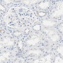 Invitrogen™ Glutamine Synthetase Polyclonal Antibody