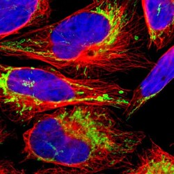 Invitrogen ACAT1 Polyclonal Antibody 100 &mu;L; Unconjugated:Antibodies,
