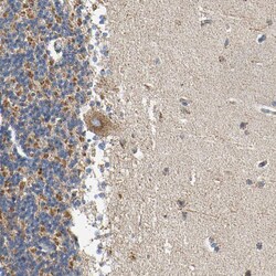 Invitrogen ACAT1 Polyclonal Antibody 100 &mu;L; Unconjugated:Antibodies,
