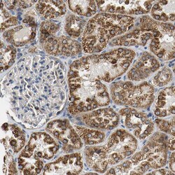 Invitrogen ACAT1 Polyclonal Antibody 100 &mu;L; Unconjugated:Antibodies,