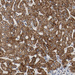 Invitrogen ACAT1 Polyclonal Antibody 100 &mu;L; Unconjugated:Antibodies,