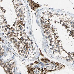 Invitrogen ACAT1 Polyclonal Antibody 100 &mu;L; Unconjugated:Antibodies,