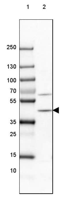 Invitrogen PHYH Polyclonal Antibody 100 &mu;L; Unconjugated:Antibodies,