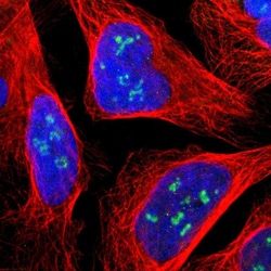 Invitrogen JMJD2A Polyclonal Antibody 100 &mu;L; Unconjugated:Antibodies,
