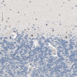 Invitrogen JMJD2A Polyclonal Antibody 100 &mu;L; Unconjugated:Antibodies,