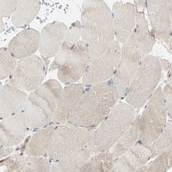 Invitrogen JMJD2A Polyclonal Antibody 100 &mu;L; Unconjugated:Antibodies,