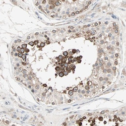 Invitrogen JMJD2A Polyclonal Antibody 100 &mu;L; Unconjugated:Antibodies,