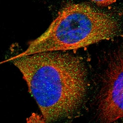 Invitrogen FER Polyclonal Antibody 100 &mu;L; Unconjugated:Antibodies,