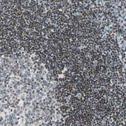 Invitrogen FER Polyclonal Antibody 100 &mu;L; Unconjugated:Antibodies,