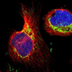 IDH2 Polyclonal Antibody, Invitrogen 100 &mu;L | Buy Online | Thermo Scientific | Fisher Scientific