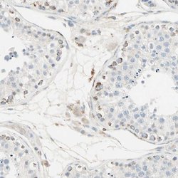 IDH2 Polyclonal Antibody, Invitrogen 100 &mu;L | Buy Online | Thermo Scientific | Fisher Scientific