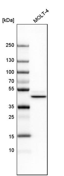 IDH2 Polyclonal Antibody, Invitrogen 100 &mu;L | Buy Online | Thermo Scientific | Fisher Scientific