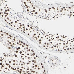 Invitrogen PRMT3 Polyclonal Antibody 100 &mu;L; Unconjugated:Antibodies,