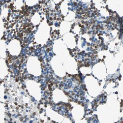 CLEC4A Polyclonal Antibody:Antibodies, Polyclonal