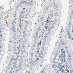 CLEC4A Polyclonal Antibody:Antibodies, Polyclonal