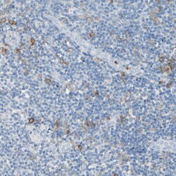 CLEC4A Polyclonal Antibody:Antibodies, Polyclonal