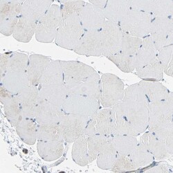 CLEC4A Polyclonal Antibody:Antibodies, Polyclonal