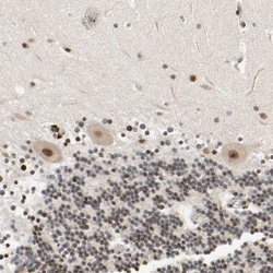 Invitrogen CDK7 Polyclonal Antibody 100 &mu;L; Unconjugated:Antibodies,